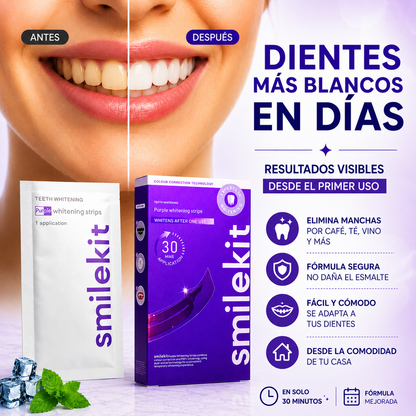 Tiras blanqueadoras dentales SmileKit, antes y después, sonrisa más blanca